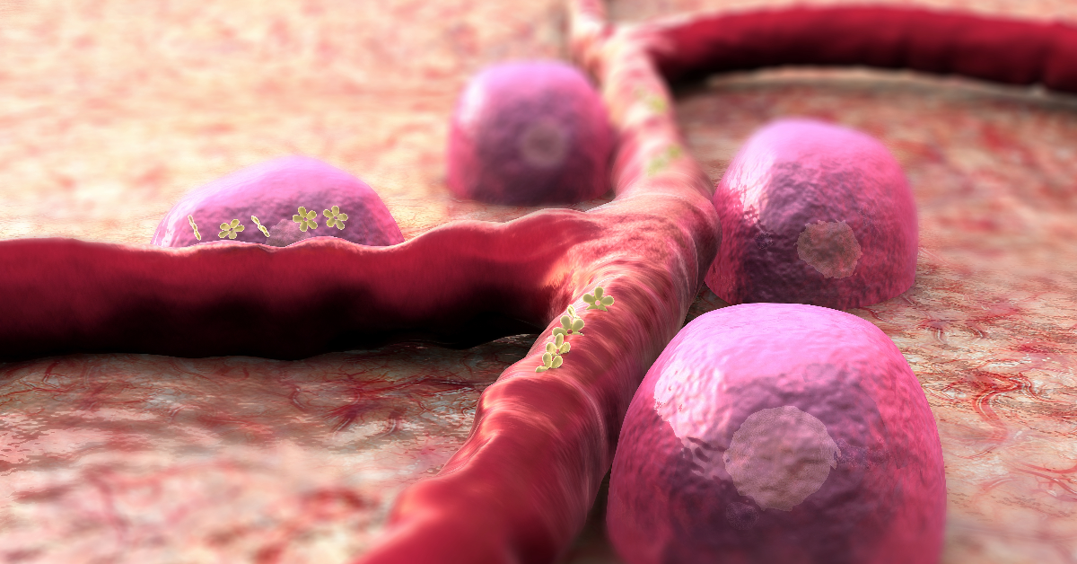 Swapping In Stem Cells For Diabetes Treatment Swapping in stem cells for diabetes treatment